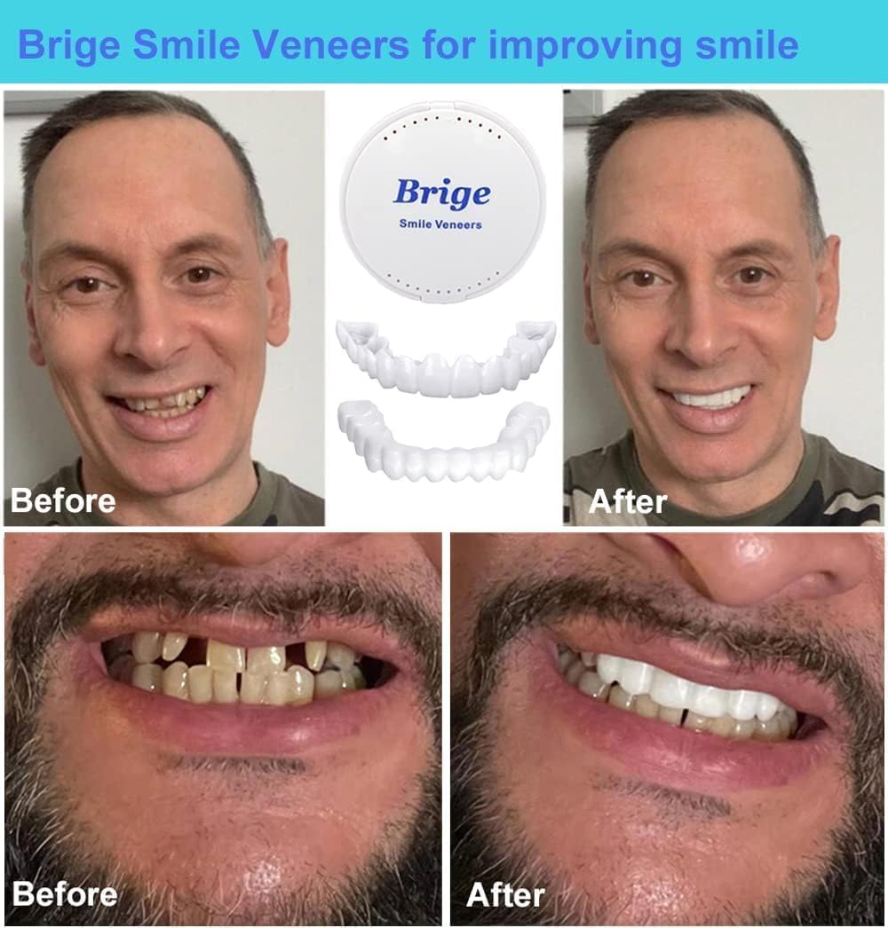 BELOXY Snap-On Instant Perfect Smile Veneers Comfortable Flex Fit Dentures for Top & Bottom Teeth White Tooth Cosmetic Cover PACK OF 1 (5) (5) (5) (1)