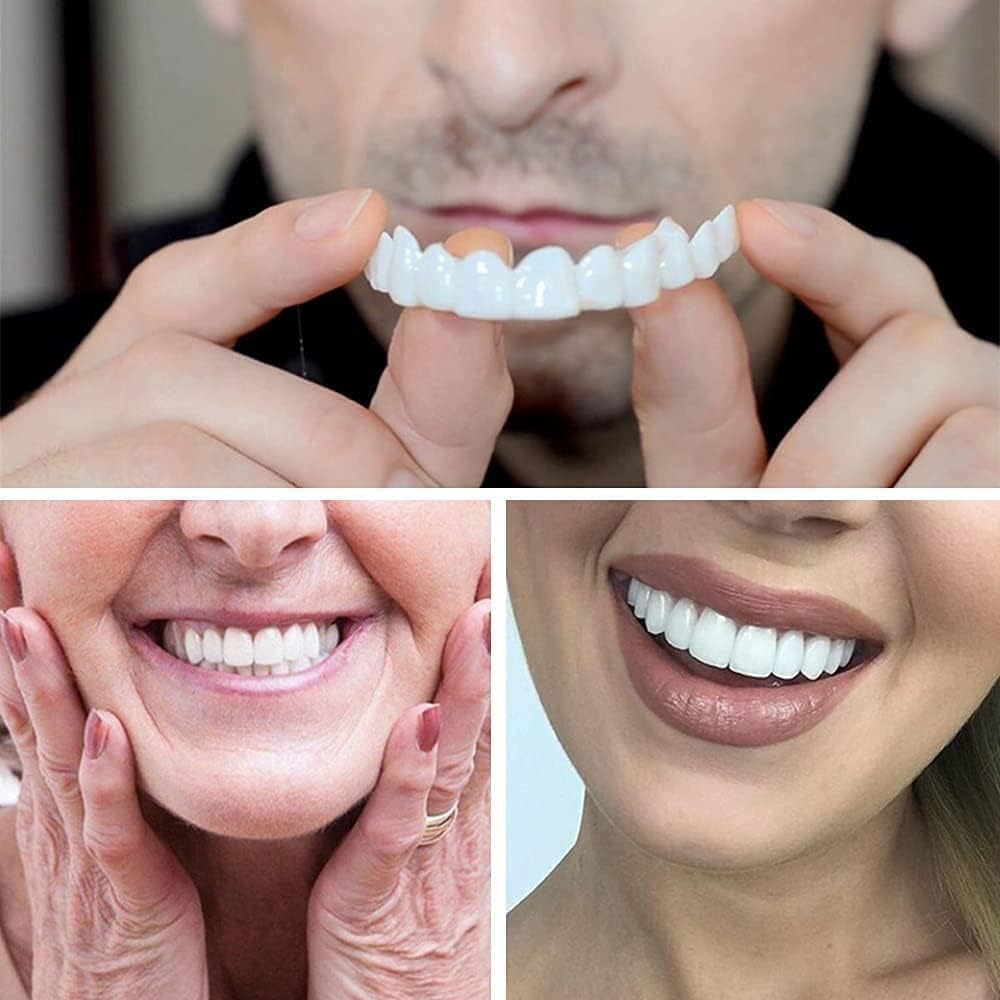 BELOXY Snap-On Instant Perfect Smile Veneers Comfortable Flex Fit Dentures for Top & Bottom Teeth White Tooth Cosmetic Cover PACK OF 1 (5) (5) (5) (1)