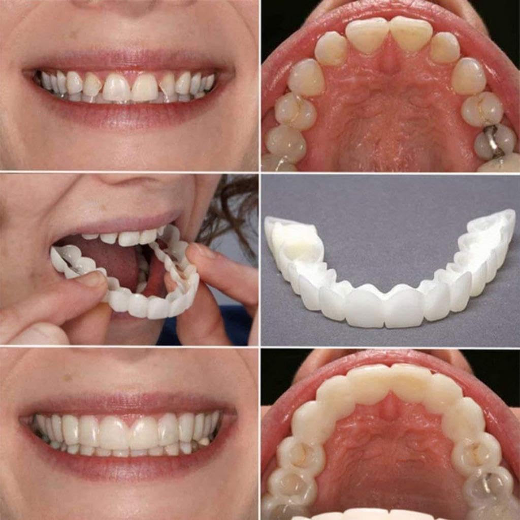 BELOXY Snap-On Instant Perfect Smile Veneers Comfortable Flex Fit Dentures for Top & Bottom Teeth White Tooth Cosmetic Cover PACK OF 1 (5) (5) (5) (1)